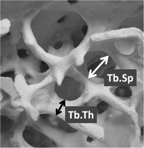 trabecular thickness measurement|lamellar bone vs trabecular.